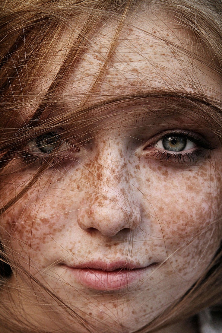 What Are Freckles Fashionsizzle 