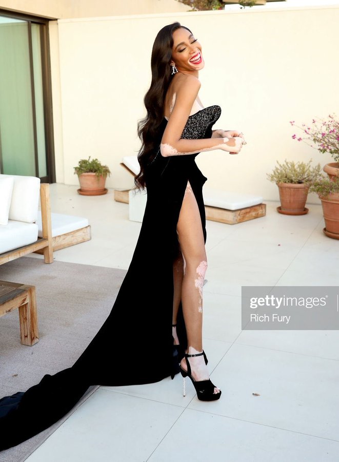 winnie-harlow-in-ralph-russo-presenting-the-2020-mtv-emas
