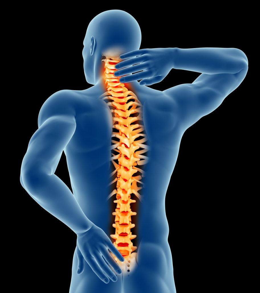 is-spinal-arthritis-curable