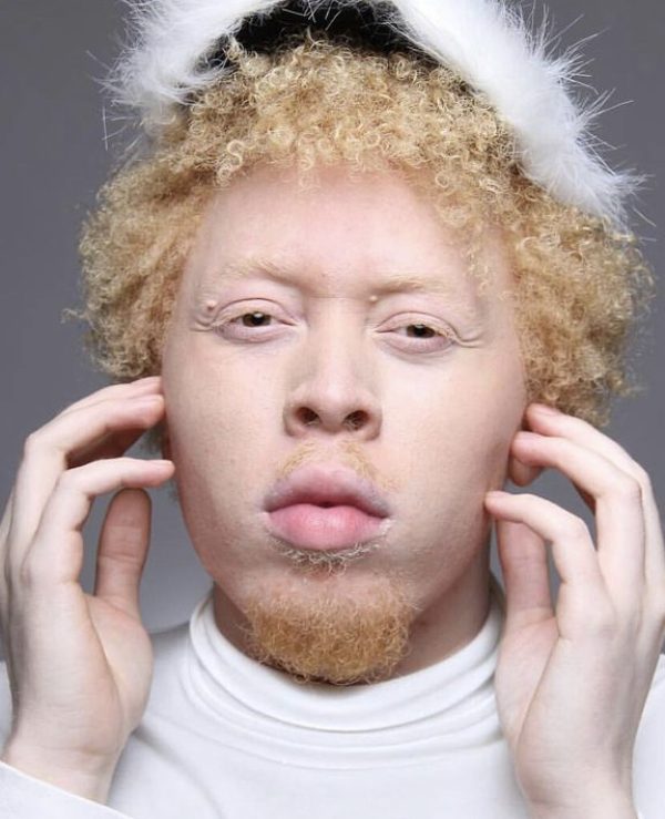 Albino model participates  in SIZZLE ARTS DIVERSITY MODEL PROGRAM