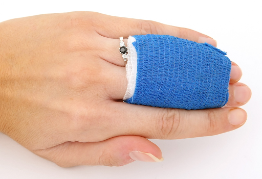 How To Deal After A Severe Burn Injuries